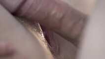SPERMAGENUG