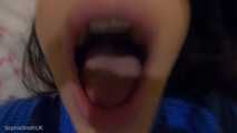 Inside My Mouth