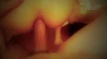 MASSIVE ANAL