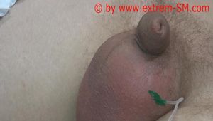 Instructions Video scrotal saline infusion English text the long version