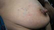 before and after breast busting scene 