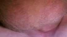WITHOUT RUBBER FUCKED