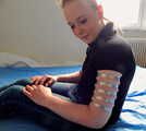 Lea wearing five very tight hose clamps on each arm