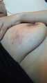 before and after breast busting scene 