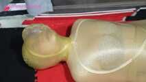 Xiaomeng Condom Capping and Latex Hooding