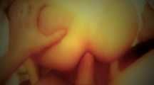 MASSIVE ANAL
