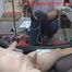 Instructions Video scrotal saline infusion English text the long version