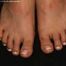 Pedicure Pics