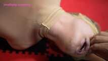 Xiaomeng Condom Capping and Latex Hooding