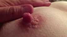 MEINE TITTENNIPPEL