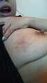 before and after breast busting scene 