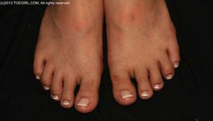 Pedicure Pics