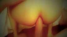 MASSIVE ANAL