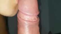 BRAV GESCHLUCKT