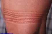 Extremly tied pics
