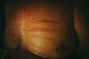 Nippel - Piercing mit Striemen vom Rohrstock