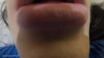 Inside My Mouth